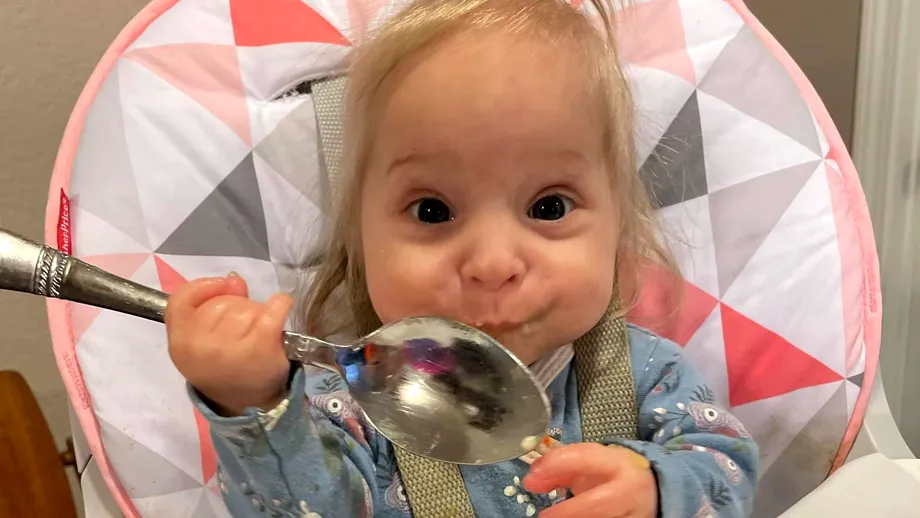 Cel mai mic copil de 2 ani: fetița cântărește 3 kilograme. Boala rară de care suferă