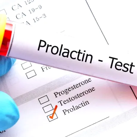 Prolactina – tot ce trebuie să știi despre acest hormon al supraviețuirii speciilor