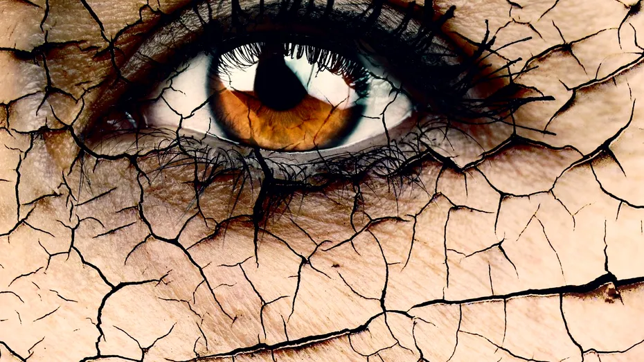 Pielea, „victima preferată” a schimbărilor bruște de temperatură. Cum previi uscăciunea și crăparea pielii