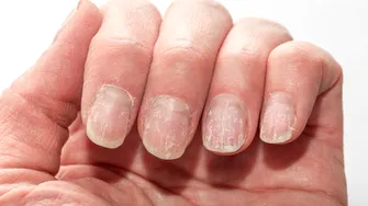 Unghiile pot semnala boli grave. Semnul discret care poate indica probleme ale inimii, ficatului sau rinichilor