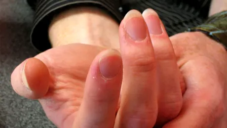 Cum să repari o unghie ruptă cu ajutorul unor produse din bucătărie! Metoda e simplă și eficientă