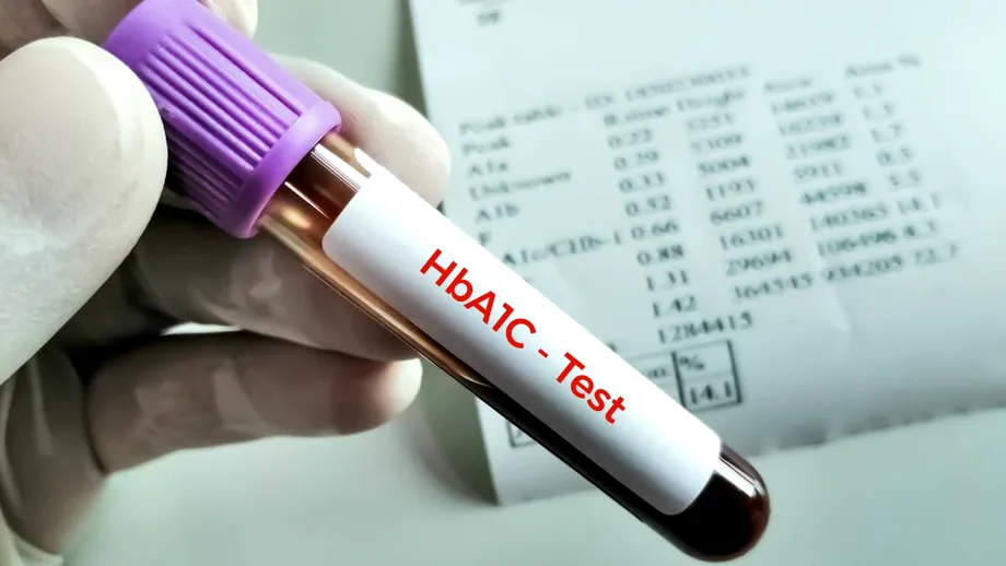 De ce poate crește hemoglobina glicată (HbA1c)? Glicemia ridicată nu este singura explicație