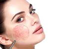 Adio, rozacee! Dr. Amalia Anghel: „Roșeața facială poate fi gestionată cu succes printr-o abordare atentă și conștientă a îngrijirii pielii…”