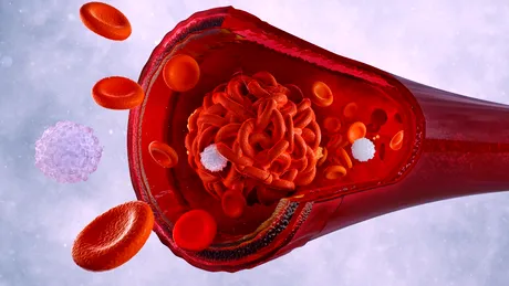 Cinci alimente care curăță arterele și îmbunătățesc circulația sanguină. Cum îți protejezi inima