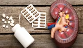 STUDIU. Combinarea medicamentelor pentru hipertensiune cu ibuprofenul crește riscul de boli renale