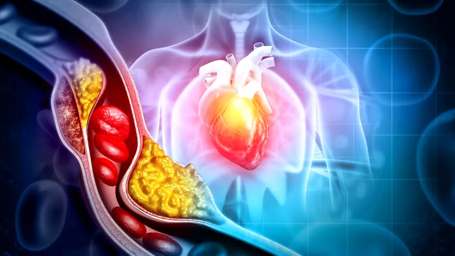 Alimentele care „sugrumă” inima cu colesterol. Ce să mănânci ca să cureți sângele de grăsime