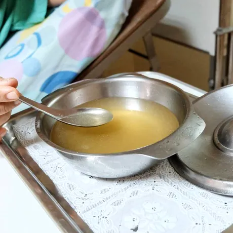 Ce ai voie să mănânci după colonoscopie. Alimente care îți refac stomacul