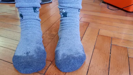 3 mituri despre leacurile băbești. De ce NU E BINE să porți șosete cu oțet sau să pui albuș pe o arsură