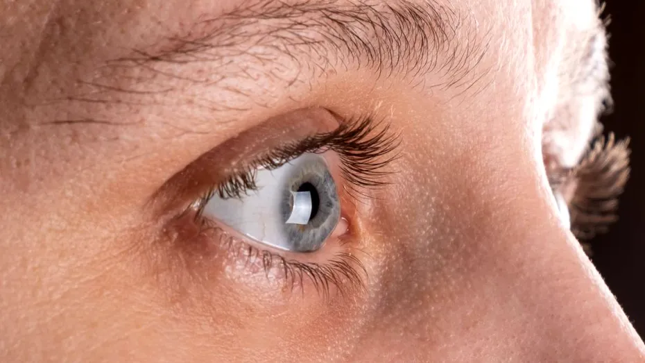 Semnul subtil din sprâncene care anunță o carență