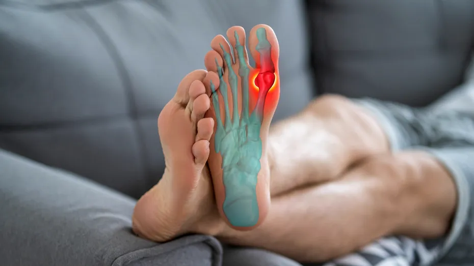 Cum sunt tratate modern monturile?