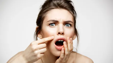 Top 7 mituri despre acnee: tipuri, cauze, tratament și prevenție