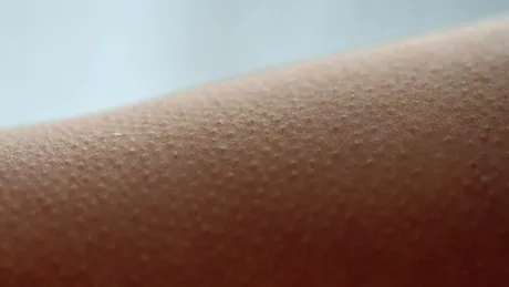 De ce ni se face pielea de găină când ascultăm muzică? Ce se întâmplă în creier și în organism