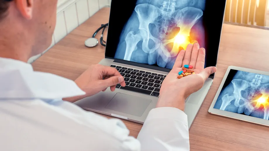 Pericolul neașteptat al corticosteroizilor folosiți în pandemie. Medic: Mulți pacienți sub 40 de ani au dezvoltat necroză de cap femural, care duce la coxartroză