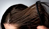 5 motive pentru care ți se îngrașă foarte repede părul. Nu mai face aceste greșeli!
