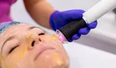 Rejuvenare facială în două etape: cum funcționează un protocol pentru revitalizarea tenului