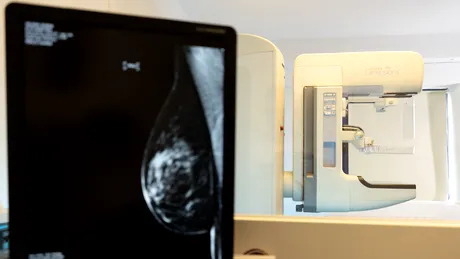 Cum se stabilește corect diagnosticul cancerului de sân?