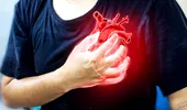 Semnele care apar pe piele și care indică boli ale inimii. Nu ignora aceste indicii vizibile