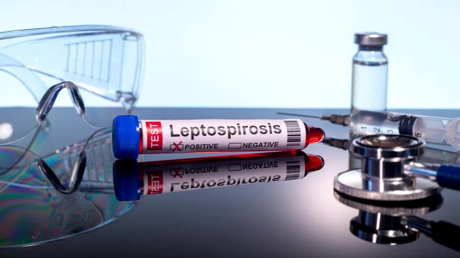 Leptospiroza: boala bacteriană care poate apărea după contactul cu apă contaminată. Cum se transmite, ce simptome are și cum poate fi prevenită