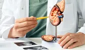 Ai boli de rinichi dar și diabet? Iată cum pot fi afectați rinichii dacă nu menții glicemia optimă