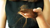 Cum poate fi prevenită căderea părului în timpul chimioterapiei. Descoperirea medicilor oncologi clujeni