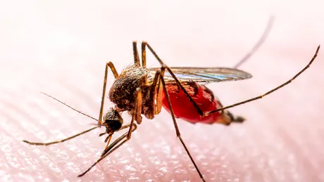 Mușcăturile de țânțari și mâncărimile. Cum facem să nu ne mai scărpinăm