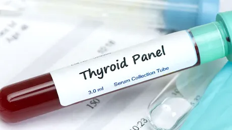 Testul TSH: nivelul hormonului de stimulare a tiroidei