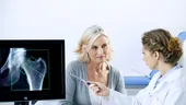 Osteoporoza, boala oaselor fragile poate fi prevenită!
