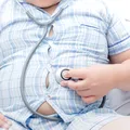 Copiii și obezitatea: o problemă complexă de înțeles, nu de judecat