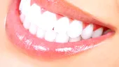 Tratamentul lunii: Restaurările dentare estetice cu ajutorul implanturilor dentare