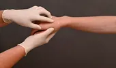 Remediul natural care șterge cicatricile, conform studiilor. Cum funcționează