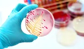 Cercetătorii au descoperit un nou antibiotic. Medicamentul care poate distruge o bacterie mortală