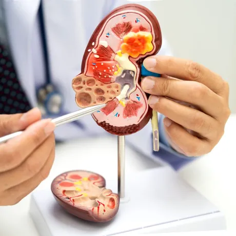 Acid uric vs creatinină: ce spun, de fapt, analizele despre sănătatea rinichilor