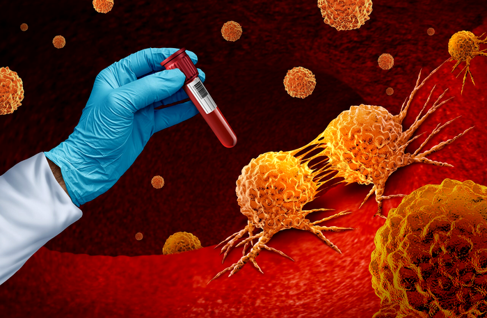 Testarea genetică pentru cancere ereditare test de sange ADN