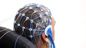 Semnul din timpul somnului asociat cu demența și Parkinson. Poate apărea cu ani înaintea diagnosticului