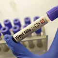 O femeie din Bihor este de două săptămâni în comă, la spital, după ce a fost infectată cu West Nile