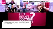 Guta: ce este și de ce apare
