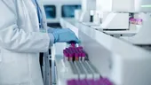 Noul test de sânge care ar putea estima riscul de deces în următorii ani