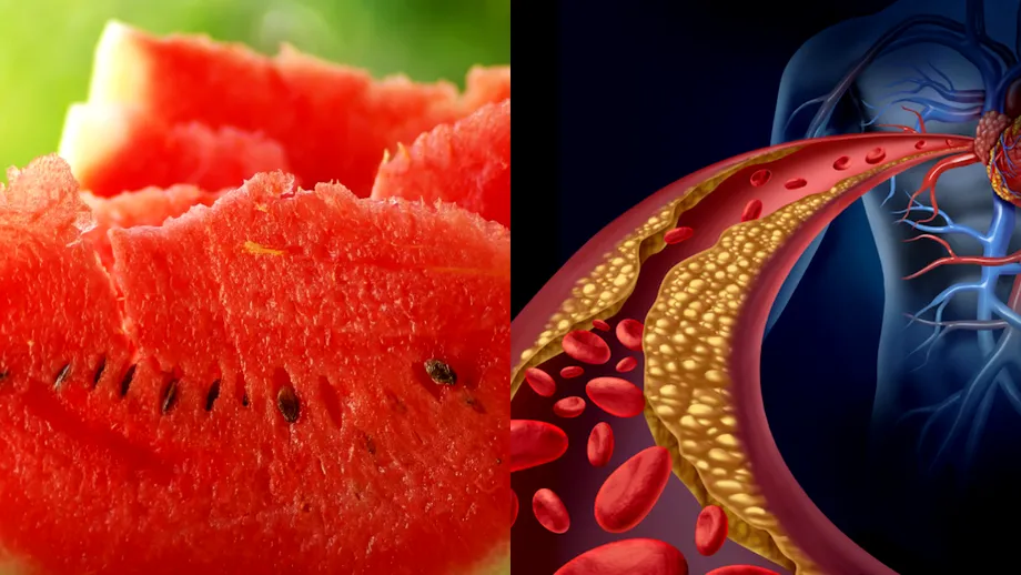 Pepenele verde scade colesterolul. Un cardiolog dezvăluie 5 alimente pe care le consumă ca să țină colesterolul scăzut și inima „sănătoasă”