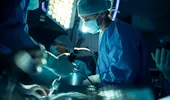 Intervenție fără cicatrici. Medicii au eliminat o tumoră din stomacul unui pacient de 80 de ani, fără nicio tăietură