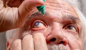 Cataracta, tratată cu laser femtosecunde: ce trebuie să știi despre intervenție