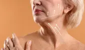 Liftingul cervical: când gâtul are nevoie de chirurgie și nu de încă un tratament estetic