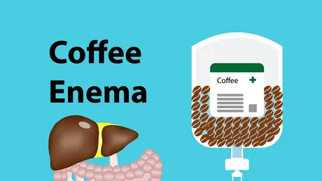 Beneficiile neobișnuite ale clismelor cu cafea. Detoxifiere și revitalizare pentru corpul tău