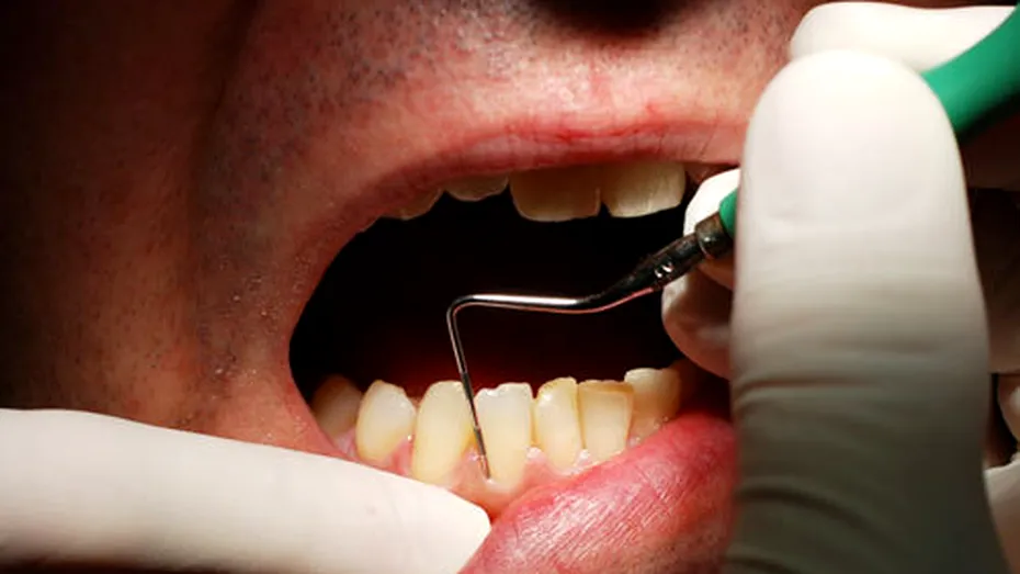 Cum poate o vizită la dentist să te îmbolnăvească de Hepatita C