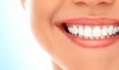 Vrei să-ţi albeşti dintii? Iată 8 lucruri pe care nu le ştiai