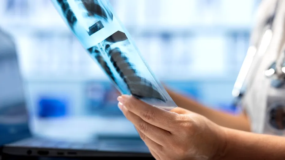 Obiectul misterios descoperit de un medic chirurg în colonul unui pacient, pe masa de operație: „M-a înțepat în deget”