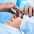 Rinoplastia, între estetică și funcționalitate: ce trebuie să știe pacienții înaintea intervenției