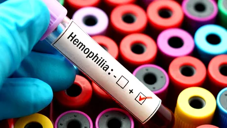 3 informații pe care cuplurile în care unul sau ambii parteneri suferă de hemofilie trebuie să le știe dacă vor copii