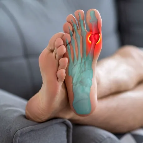 Scapă de monturi fără durere. Soluții moderne care chiar funcționează