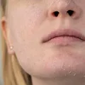 5 semne că folosești o cremă de față care nu ți se potrivește. Dacă apar aceste modificări pe piele, e timpul să schimbi rutina de îngrijire!