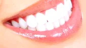 Zâmbet strălucitor cu ajutorul faţetelor dentare